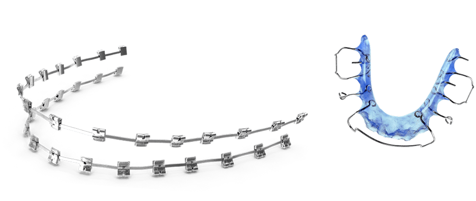 braces