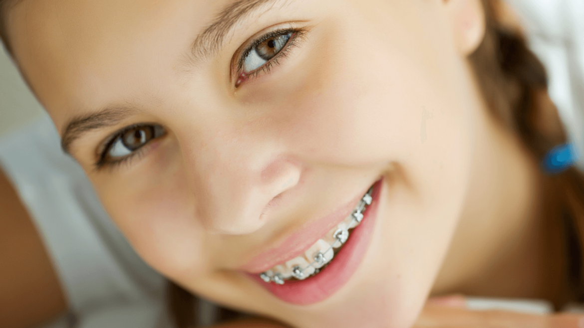 Five Hygiene Tips for Kids With Braces