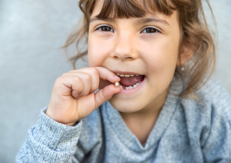 What To Do When Your Child Loses a Tooth