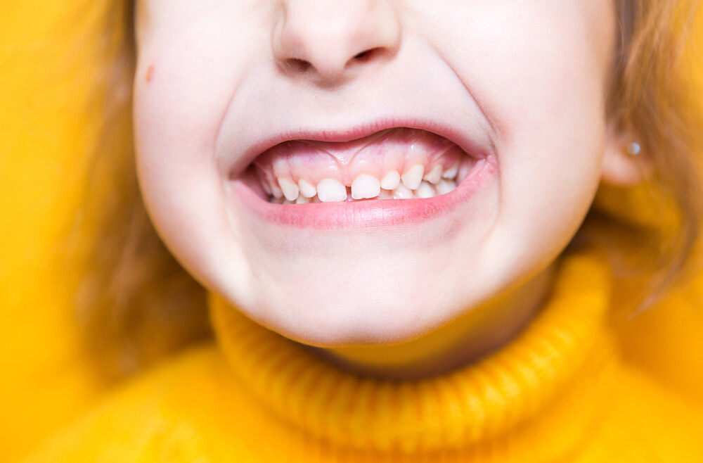 5 Ways To Improve Gum Health