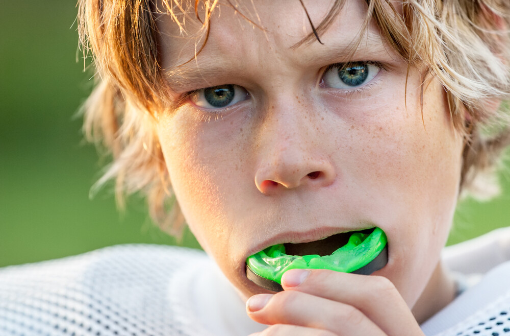 How to Prevent Dental Injuries in Kids’ Sports