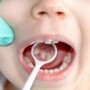 How Do You Know If Your Child Has Cavities?