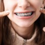 Can You Switch Orthodontists Mid-Treatment?