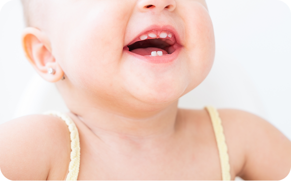 Imge for Over Retained Baby Teeth