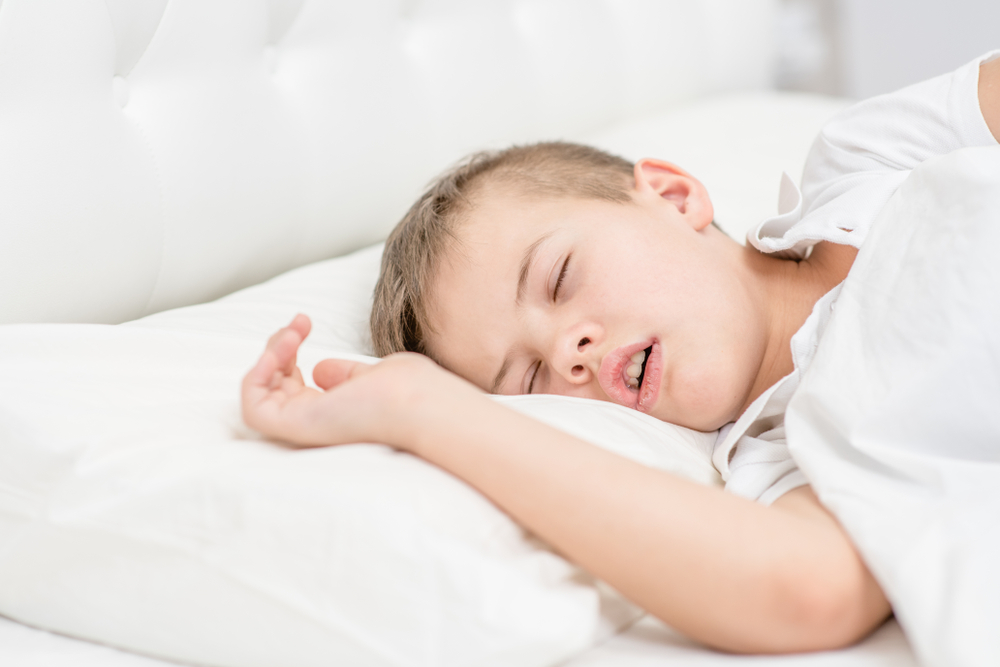 Young boy sleeping with his mouth open on a white pillow, showing signs of mouth breathing